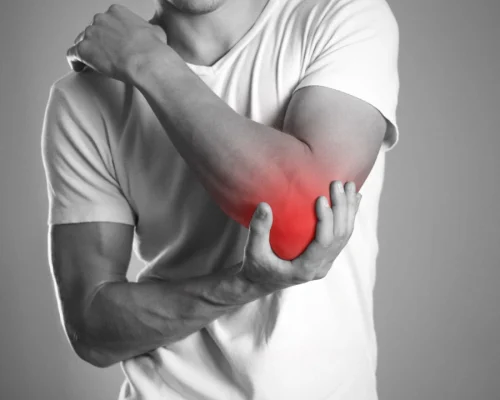 Elbow fracture