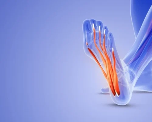 Tissue band called plantar fascia 600nw